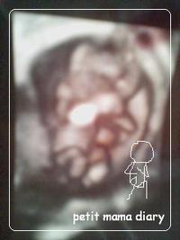 14w6d
