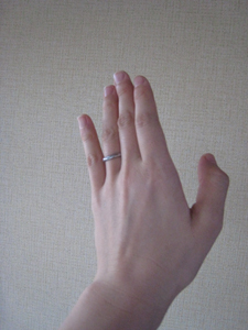 手から出ちゃったの 帝王切開術後