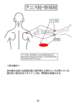 天城流湯治法　肘の痛み
