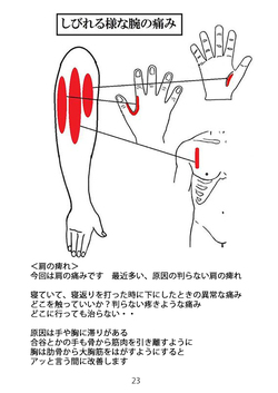 天城流湯治法　腕のしびれ
