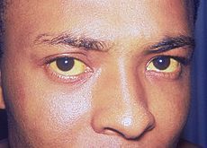 黄 い が 白目 目も老化している!?目の白目を美白にする目薬とはどんな物がある？