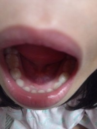 歯がぁ〜 2012/12/18 00:13:35