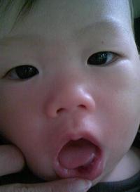 流血・・・ 2008/03/16 11:43:59