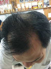 育毛… 2016/02/02 13:17:18